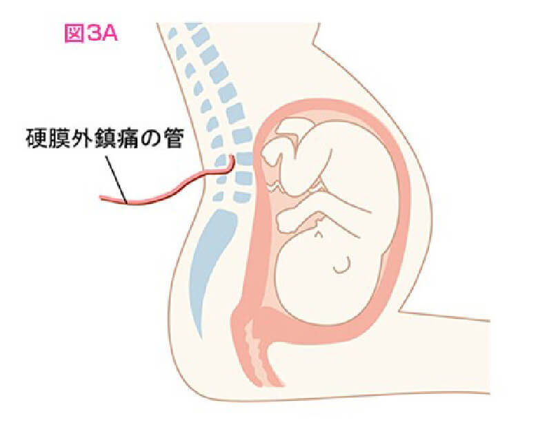 図3A お母さんの体