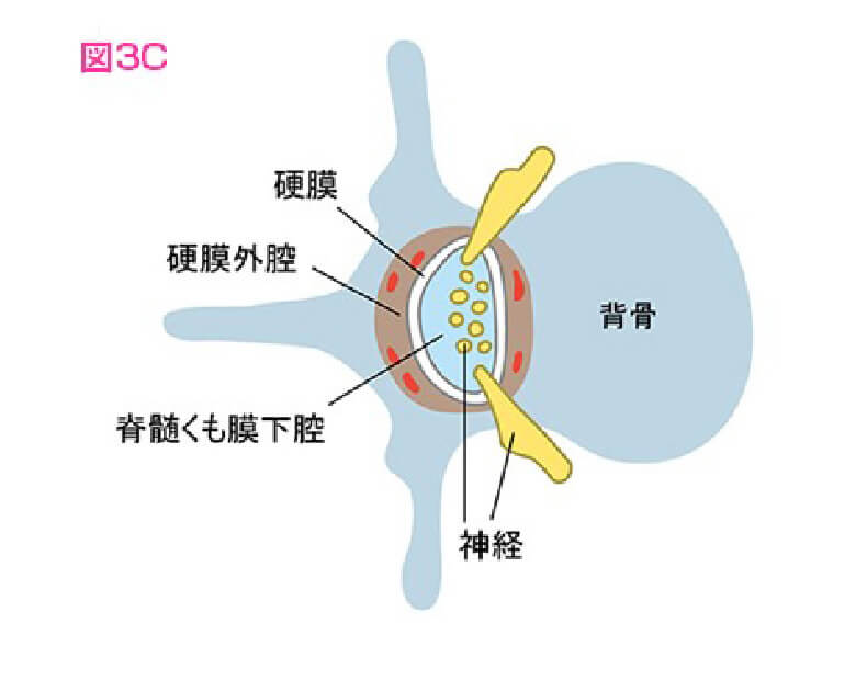 図3C 図3Bと同じ部分の背骨を水平の断面で見たもの